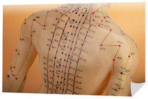 Powrót z modelu akupunktury